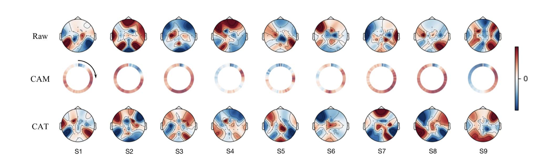 Class activation topography: class activation mapping weights displayed on the EEG topography.